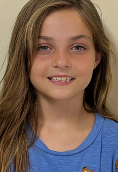 Aurora A.